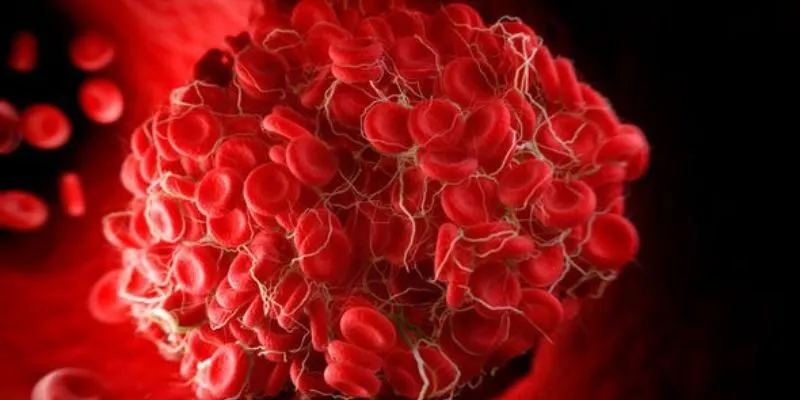 Bệnh nhiễm độc máu