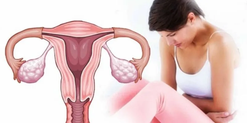 Hiếm muộn do nhiễm độc chì