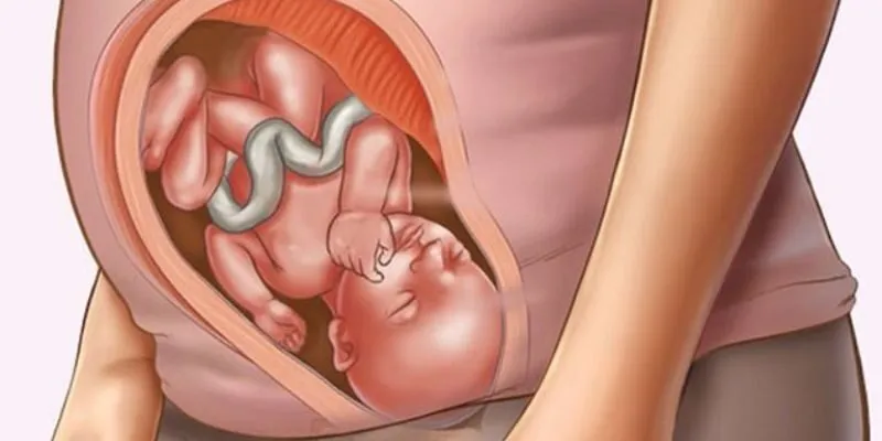 Dị dạng thai nhi