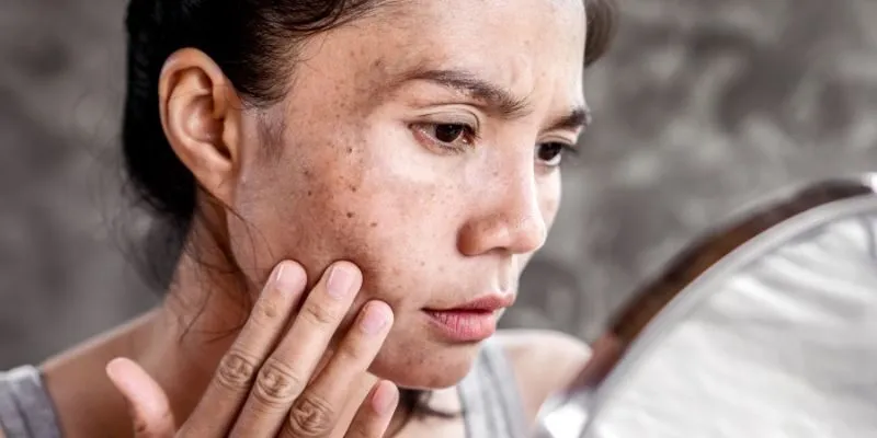 biểu hiện của nhiễm độc chì"