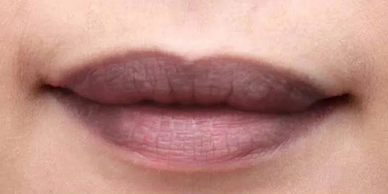 Hút chì thải độc