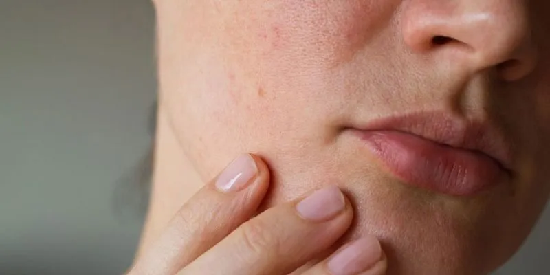 Dấu hiệu nhiễm chì