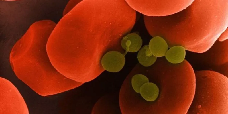 Bệnh nhiễm độc máu