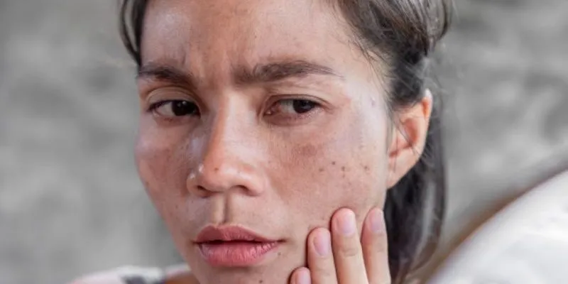 Dấu hiệu nhiễm chì