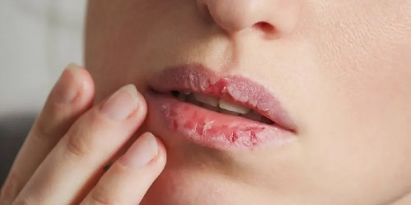 Son môi chứa độc tố