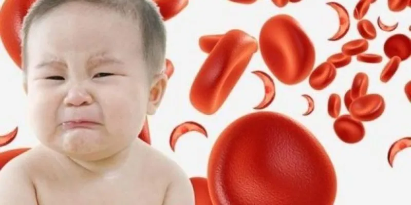 Thiếu máu ở trẻ