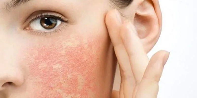 Mỹ phẩm chứa chì