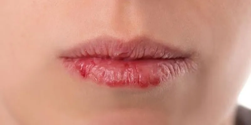 thải độc tố chì trong son môi