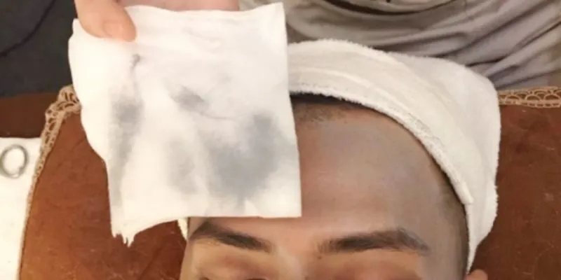 Mặt nạ hút chì